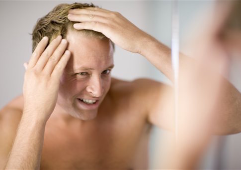 Balding